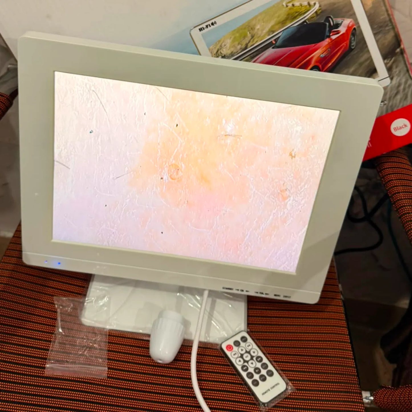 14 Inch Big Screen Skin & Hair Analyzer in Pakistan