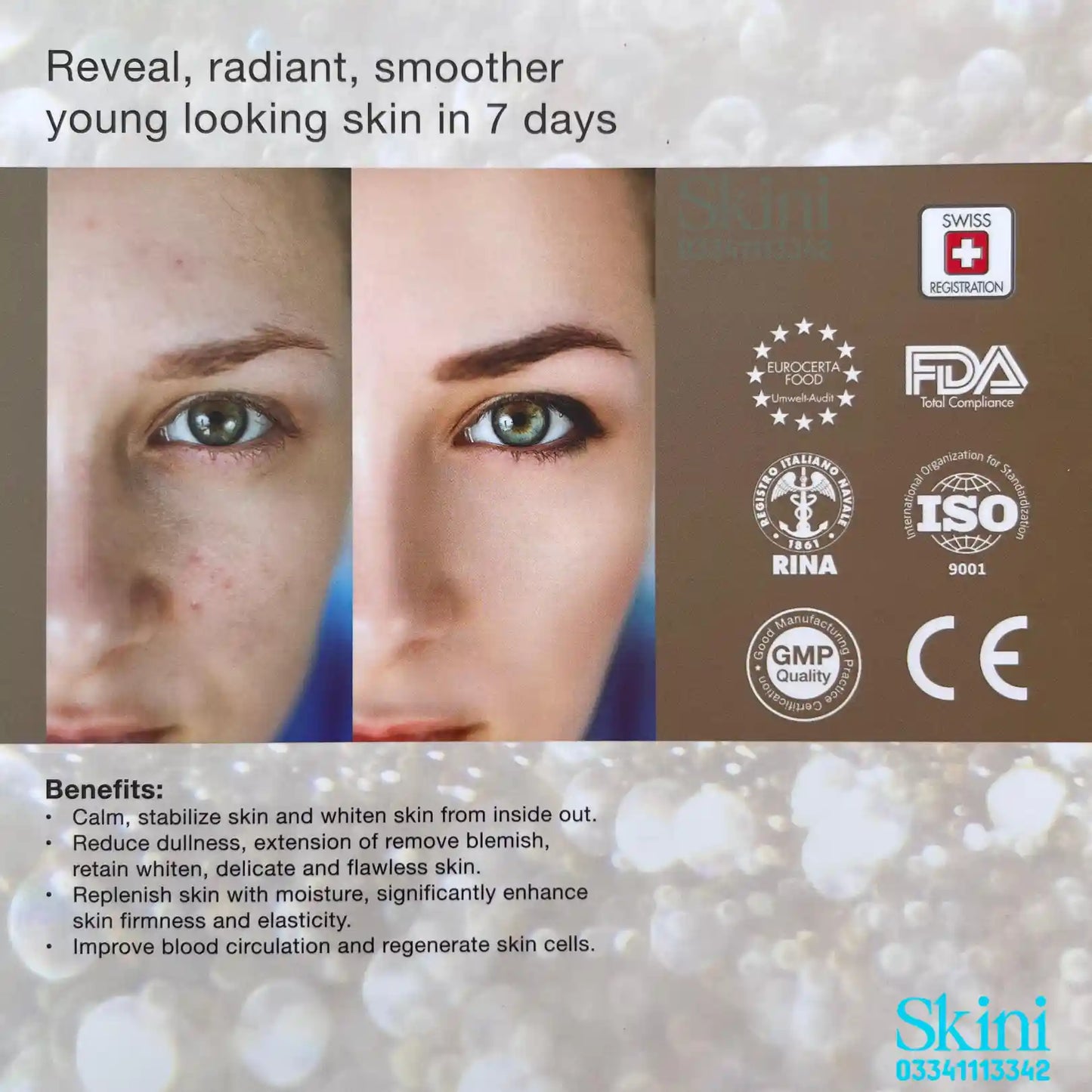 Miracle White Perfection VI – Latest Variant Skin Whitening | Anti-Aging | Scar Repair