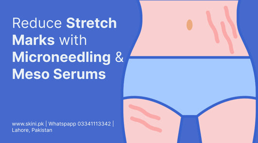 How to Remove Stretch Marks with Microneedling and Meso Serums?
