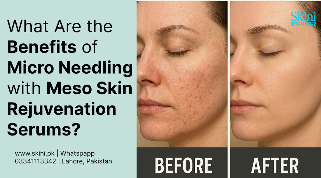 What Are the Benefits of Micro Needling with Meso Skin Rejuvenation Serums?