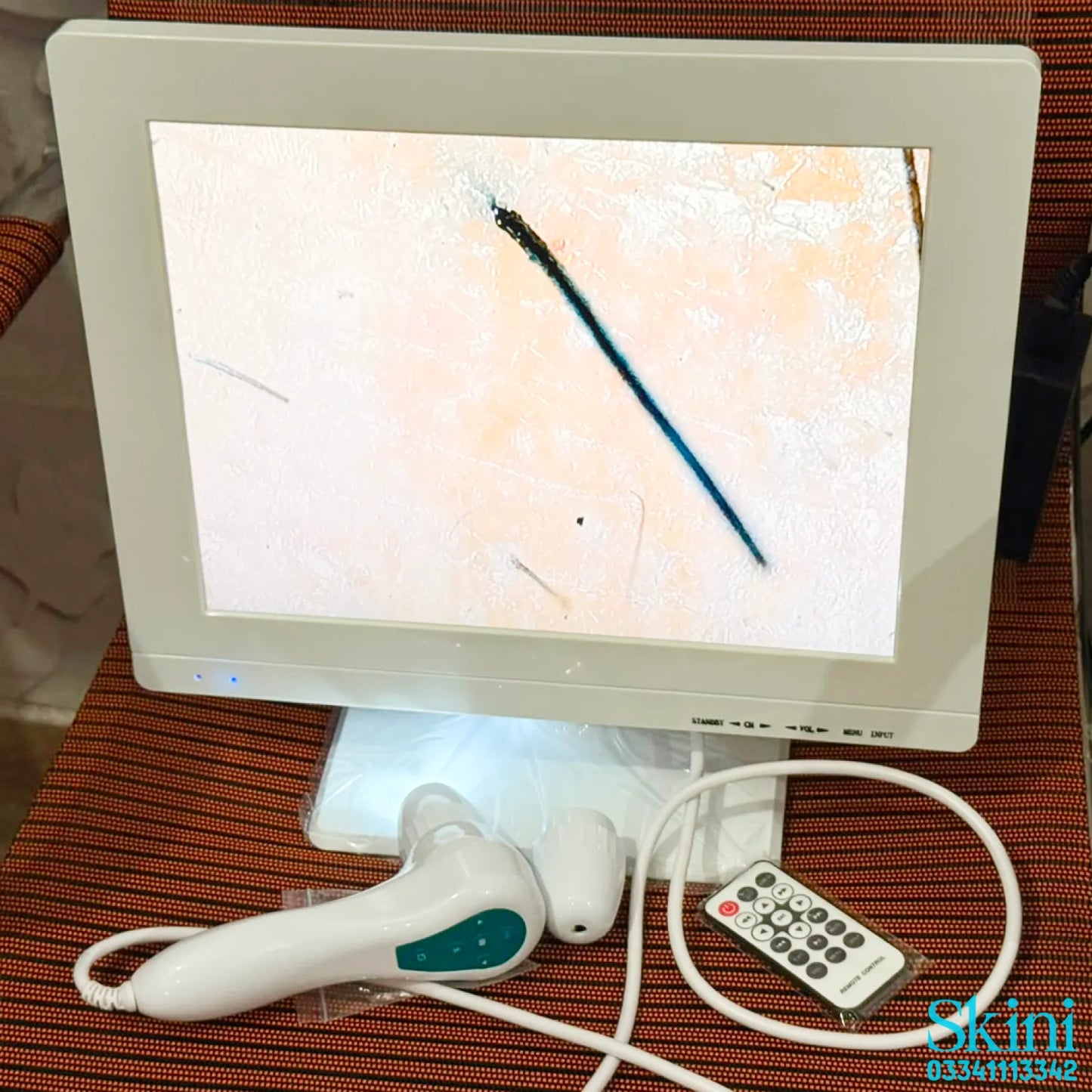 14 Inch Big Screen Skin & Hair Analyzer in Pakistan