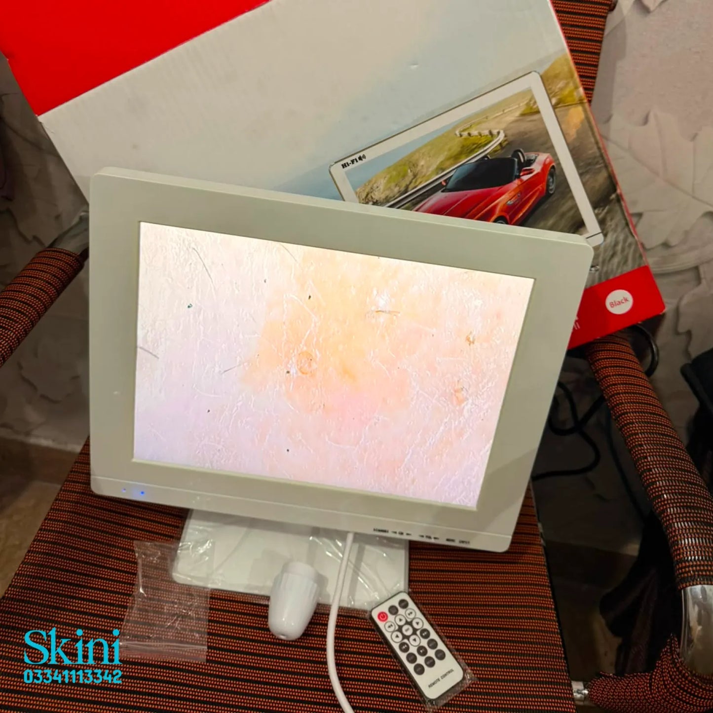 14 Inch Big Screen Skin & Hair Analyzer in Pakistan