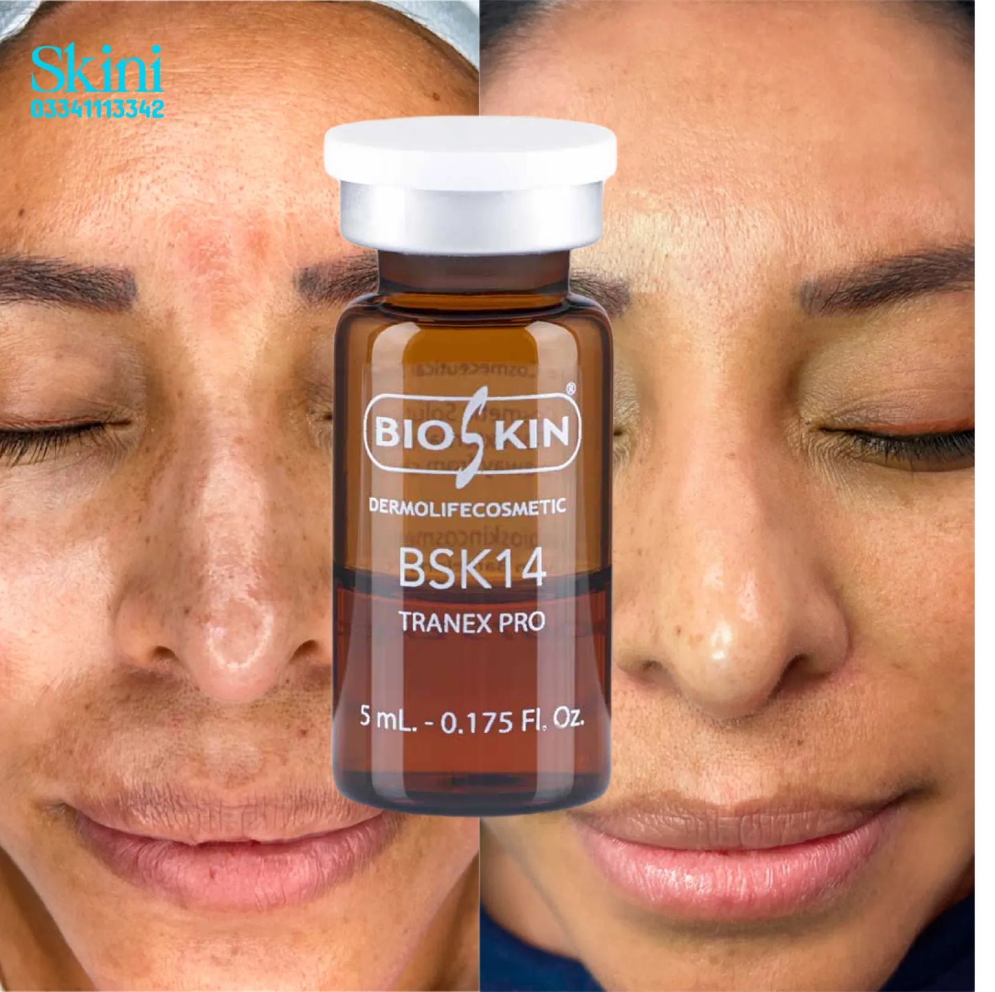 BSK14 TRANEX PRO – For Pigmentation & Skin Tone Balancing (5 x 5ml Vials)