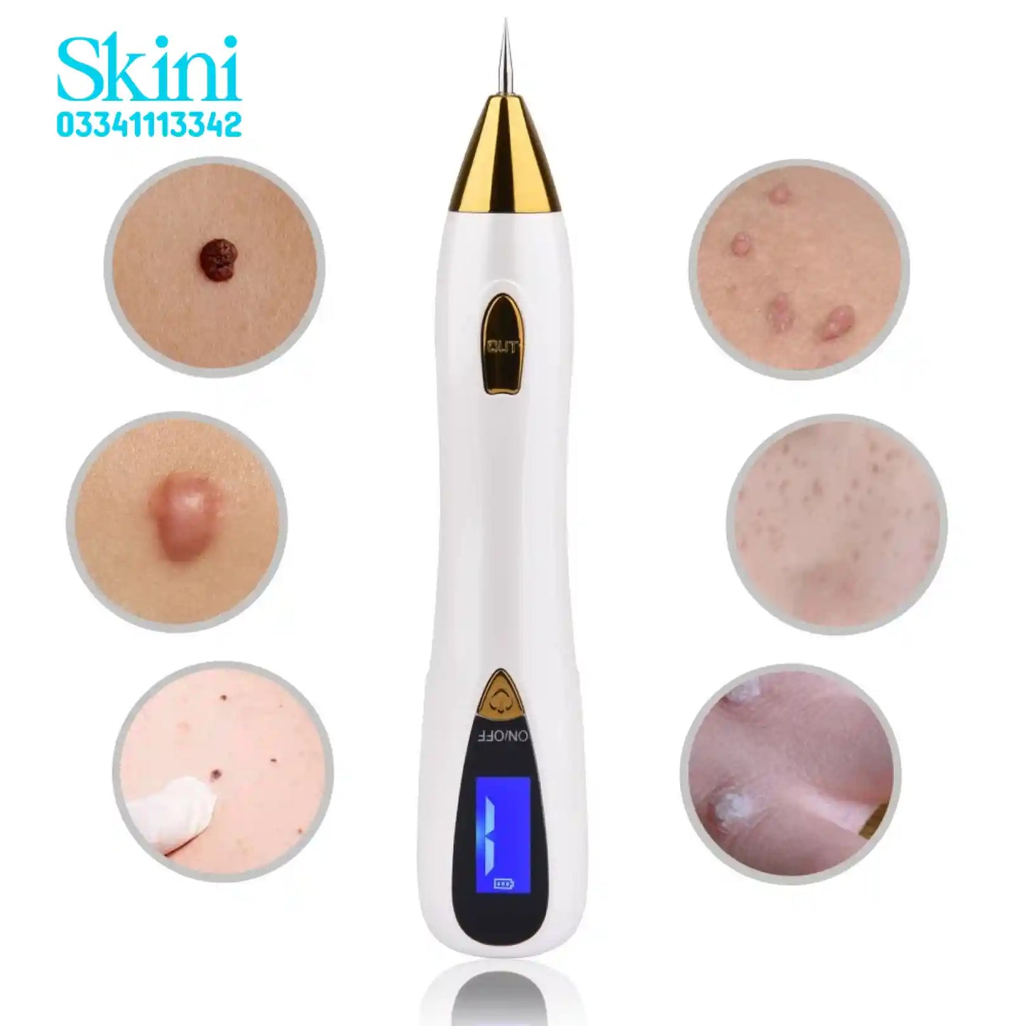 Mole Freckle Removal pen Skin Plasma Pen Beauty Tool