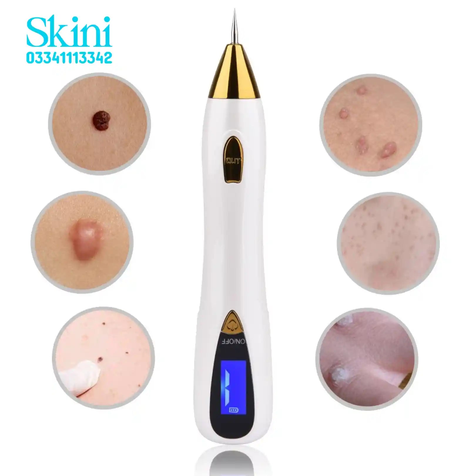 Mole Freckle Removal pen Skin Plasma Pen Beauty Tool